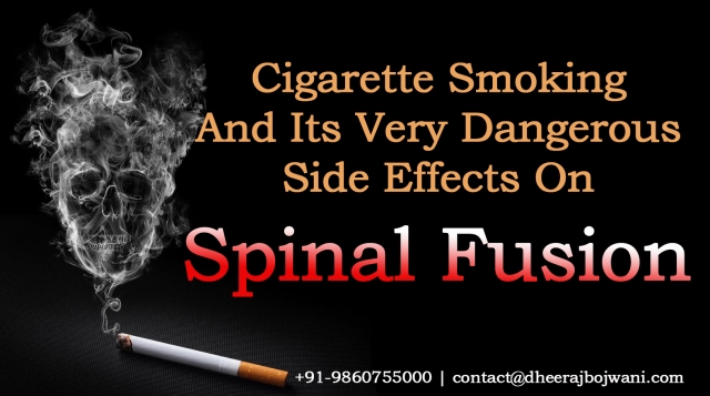 spinal-fusion-smoking